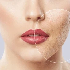 taxifolin benefits Dermatology taxifolin benefits Dermatology